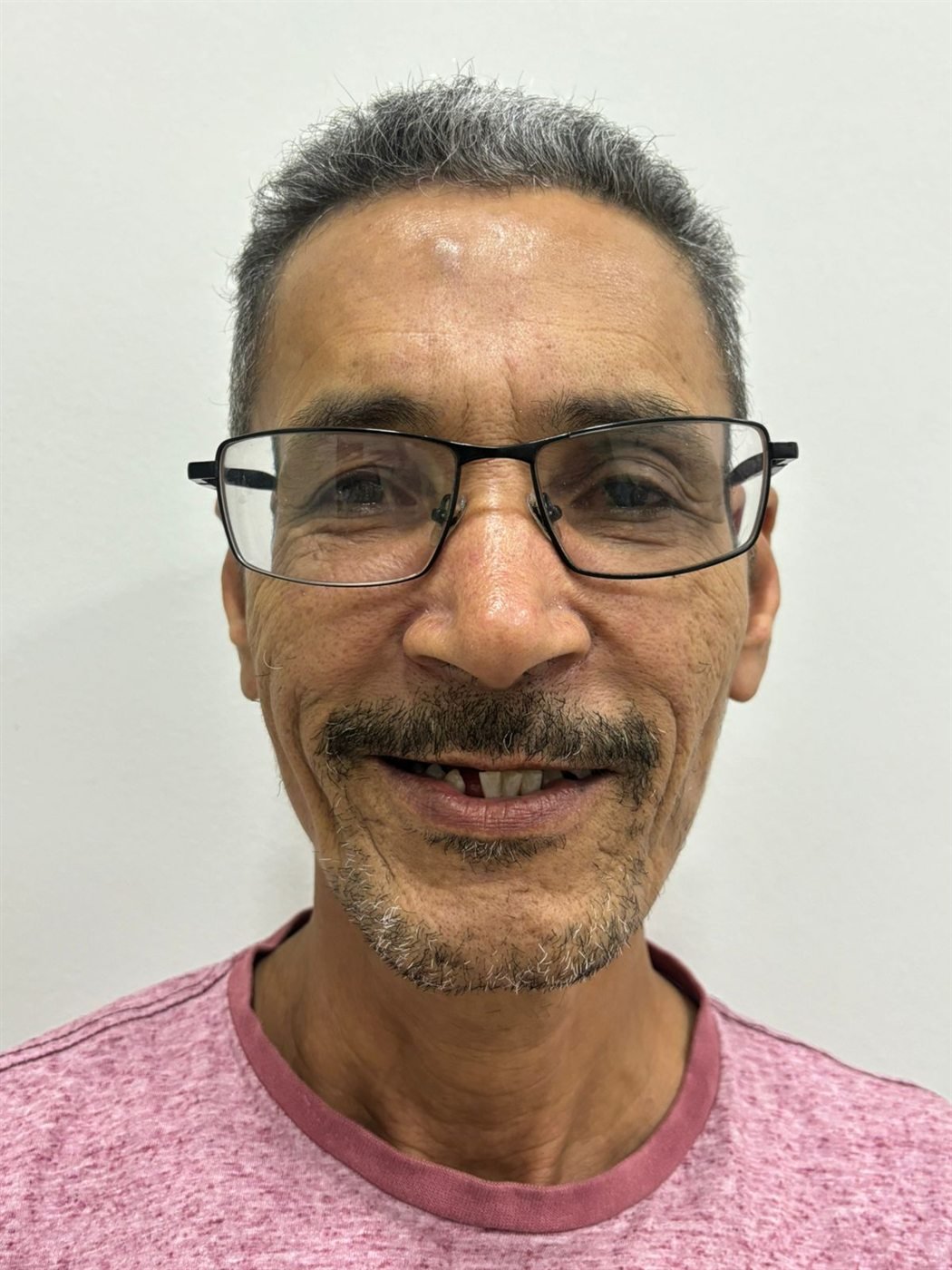 Paciente antes do tratamento, com ausência de dentes na região anterior superior.
